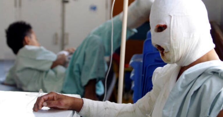 Crisis hospitalaria: Medellín alcanzó el 100% de ocupación en su área de adultos quemados