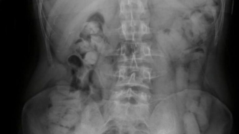 Tres ciudadanos bolivianos salieron de Jujuy con 235 cápsulas de cocaína