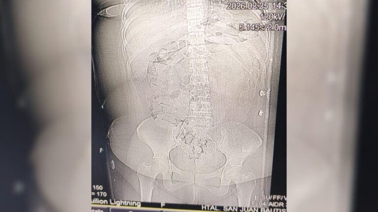 Salió de La Quiaca con 90 cápsulas de cocaína en su organismo y se descompensó